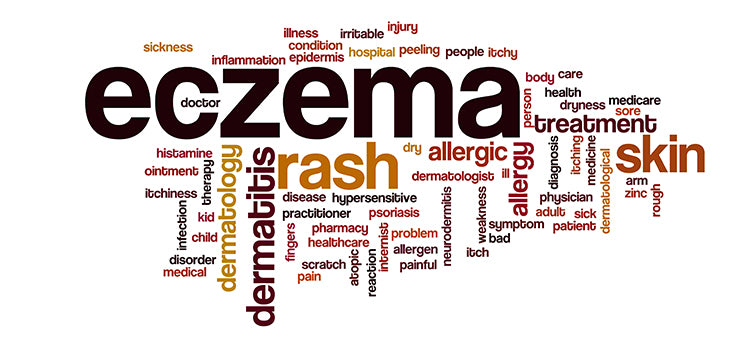 dermatologist's tips to treat eczema yourself