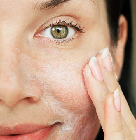 harsh skin care products that can trigger rosacea