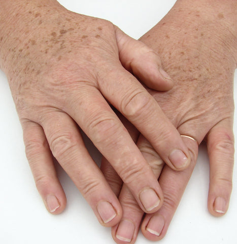 what makes your hands look old