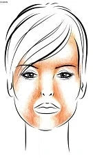 what parts of the face get seborrheic dermatitis