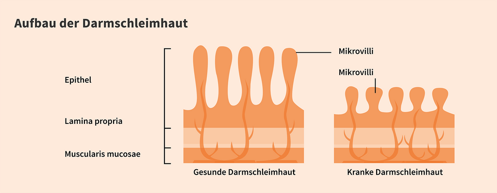 Aufbau der Darmschleimhaut: Epithel, Lamina propria, Muscularis mucosae