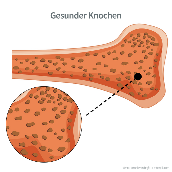 Gesunder-Knochen-ohne-Osteoporose