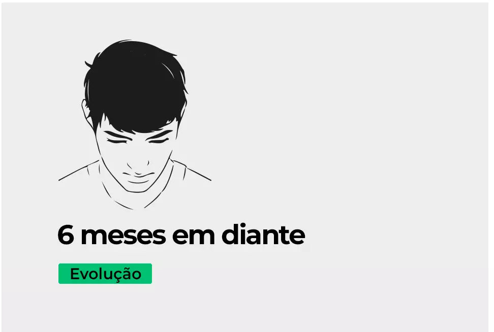 6 meses evolução produto antiqueda para cabelo produto para crescer cabelo evolução do cabelo.webp__PID:83926911-84e3-4ce6-b446-041df07d7fa7