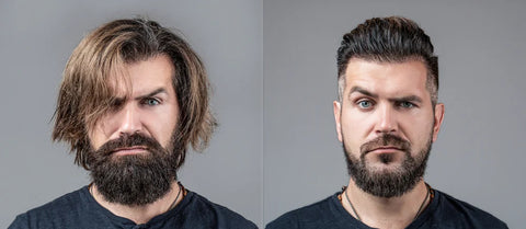 antes-e-depois-barba
