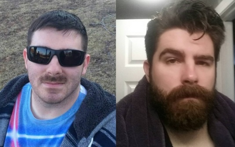 antes-e-depois-bigode