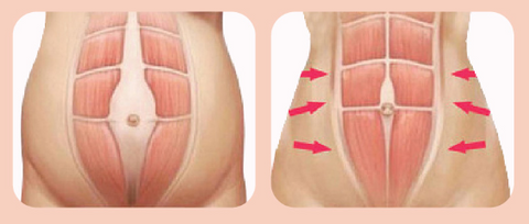 before after using the belt after pregnancy