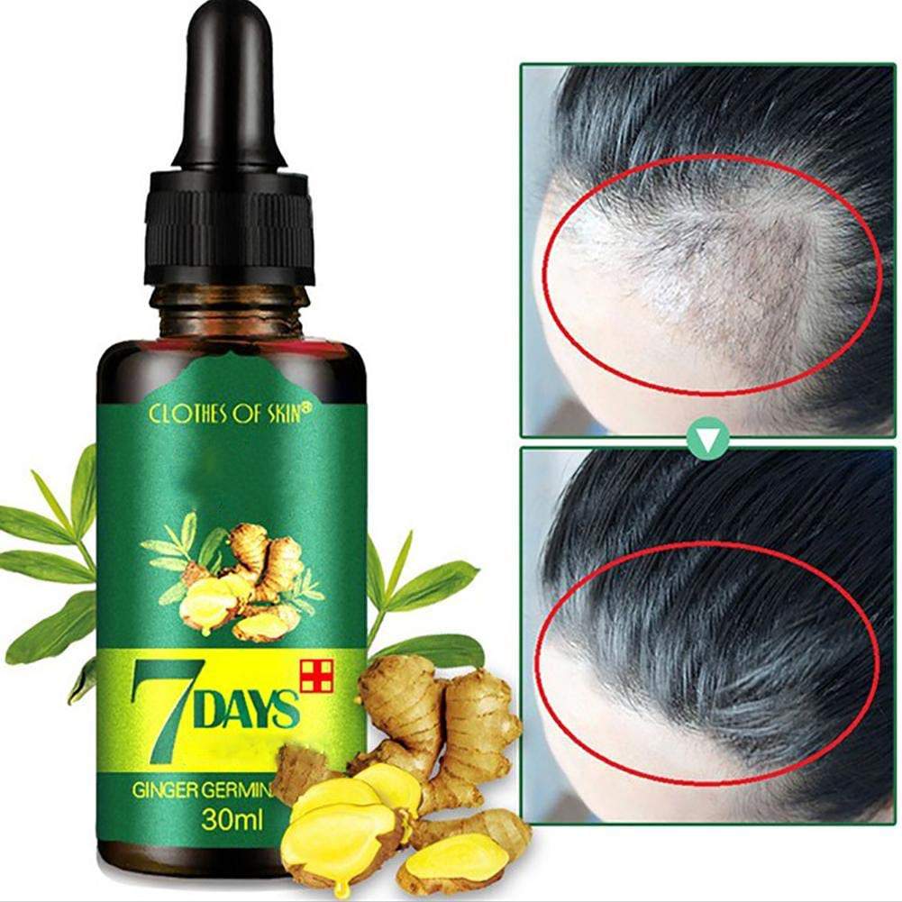 7 Days hair growth oil for baldness and hair loss cure | ZAYHAIR – zayhair