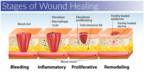 Stages of wound healing - lavender blog