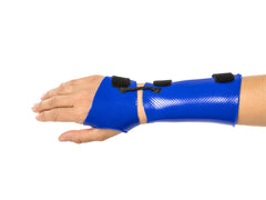 n a Dart Thrower’s Motion Orthosis, a rolled piece of Orficast can be placed to block undesired motion.
