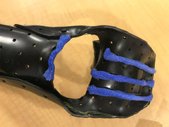 A resting orthosis with Orficast separators.