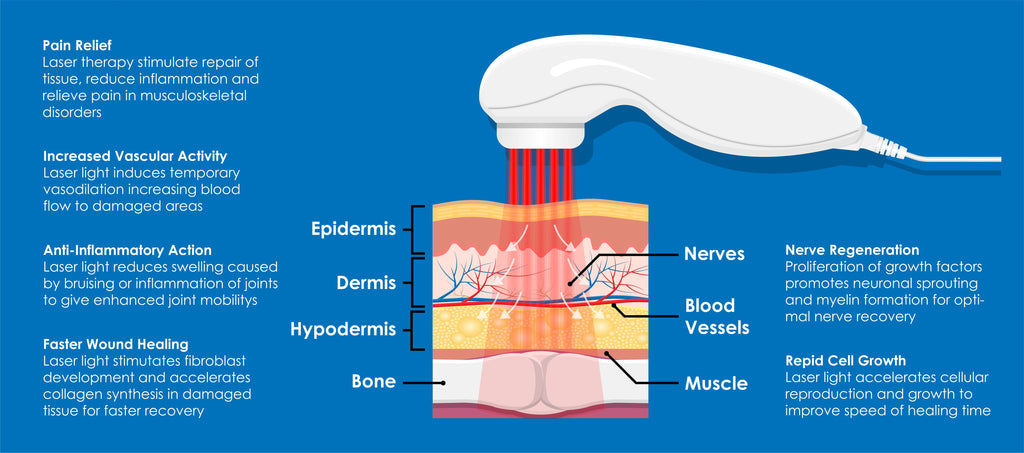 Laser therapy