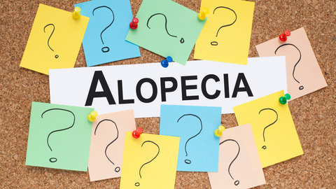image of note board with Alopecia in big letters