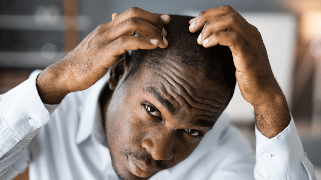 A black man checking his Hairline