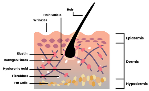 A diagram of skin structure in older skin – the collagen matrix is fragmented, and the skin surface is wrinkled. There are also fewer fibroblast cells and elastin molecules.