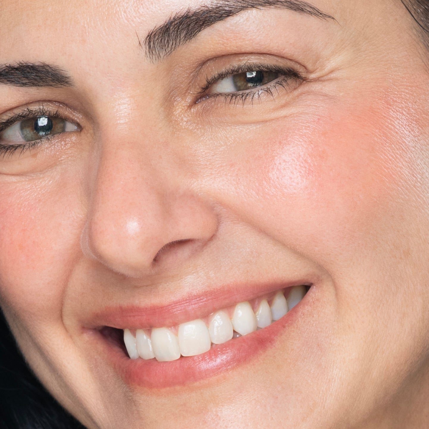 Close-up of a smiling person showing their white teeth and rosy cheeks.