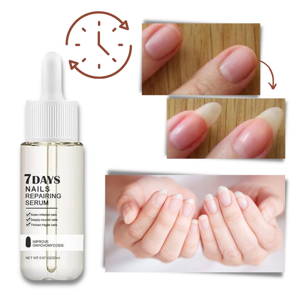 Sérum réparateur pour les ongles en 7 jours - Parfait pour une utilisation quotidienne - Ouistiprix