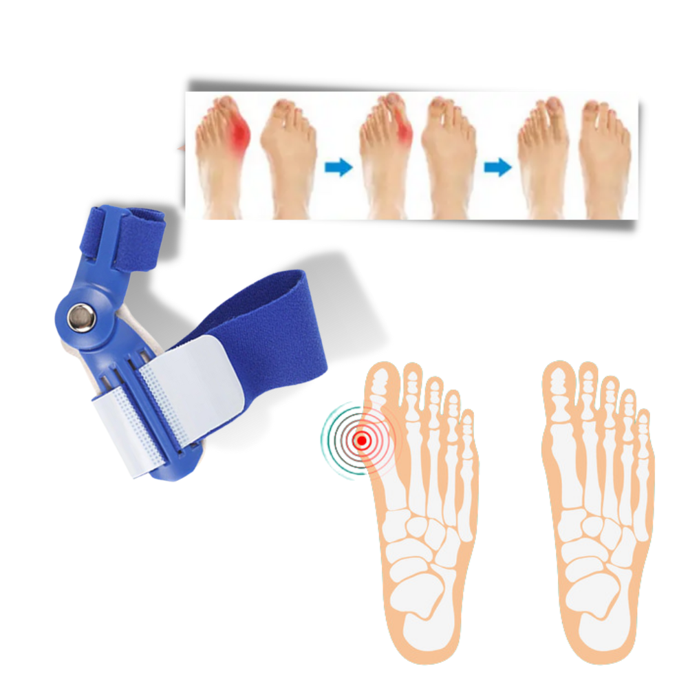 Ortopedisk Hallux valgus-stöd - 3-punkts trycksystem - Ozerty