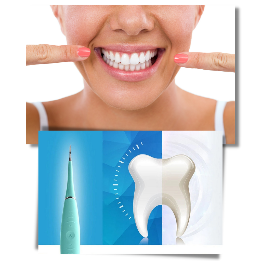 Maskin för djuprengöring av tandsten - Få vitare tänder - Ozerty
