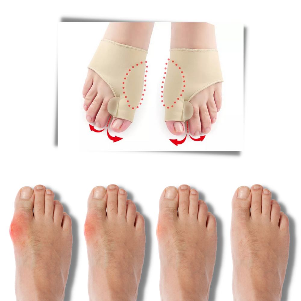 Gel bunion corrector - Comfortable and easy to use - 