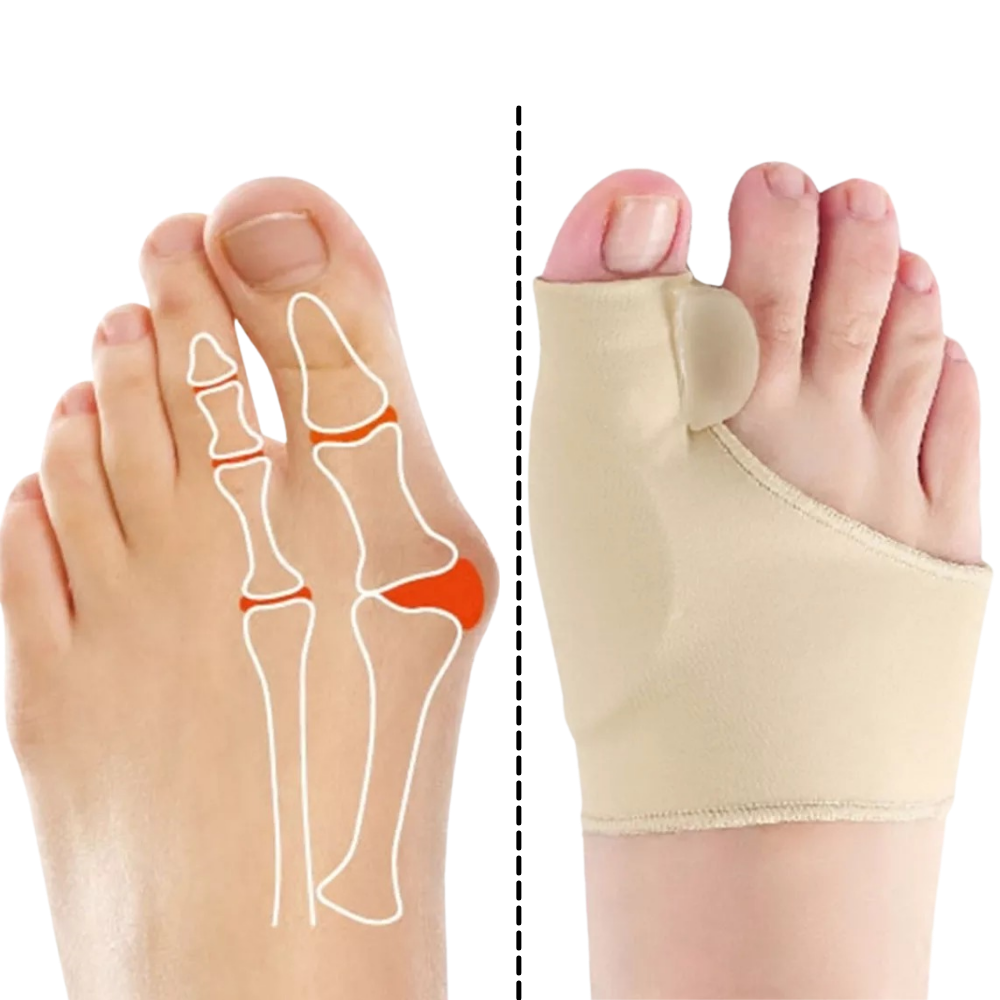 Hallux valgus support - Effective pain relief for trunk injuries - Ozerty