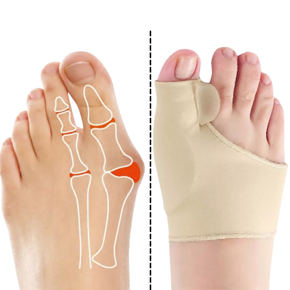 Gel Foot Bunion Corrector - Effective Pain Relief from Bunions - Ozerty