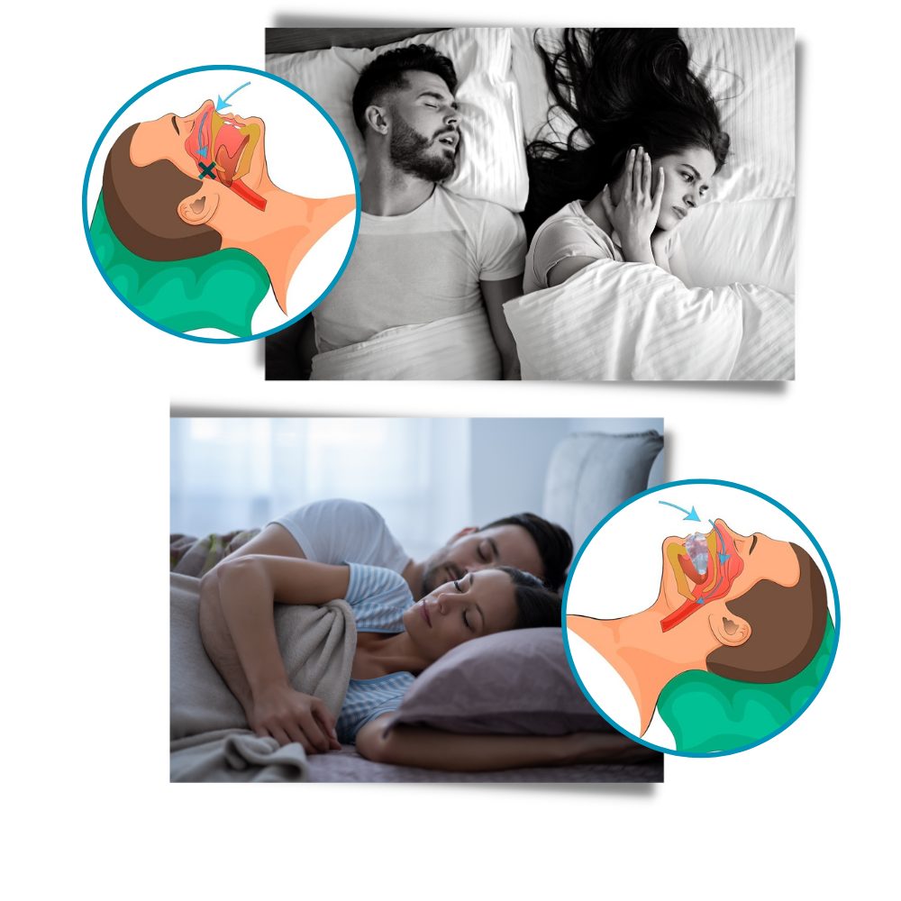 Advanced Anti-Snoring Device - Innovative Snore Reduction Technology: - Ozerty