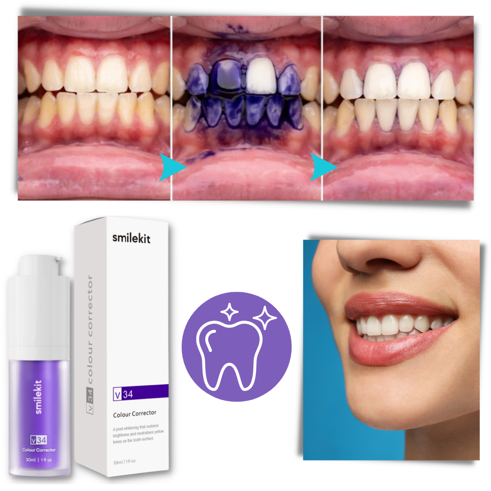 Brightening Purple Toothpaste  - Targeted Stain Concealment for a Flawless Smile - Ozerty