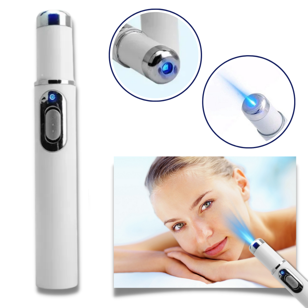  Dark Spot Remover Blue Laser Pen - Advanced Blue Laser Technology - Ozerty