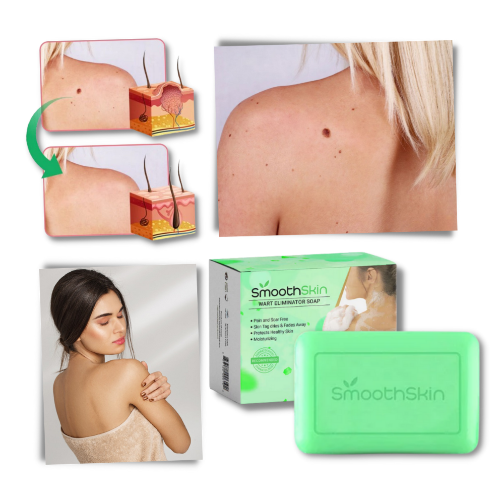 Moisturizing Exfoliator Wart Removal Soap - Ozerty