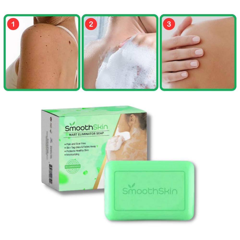 Moisturizing Exfoliator Wart Removal Soap - Gentle Exfoliation for Radiant Skin - Ozerty