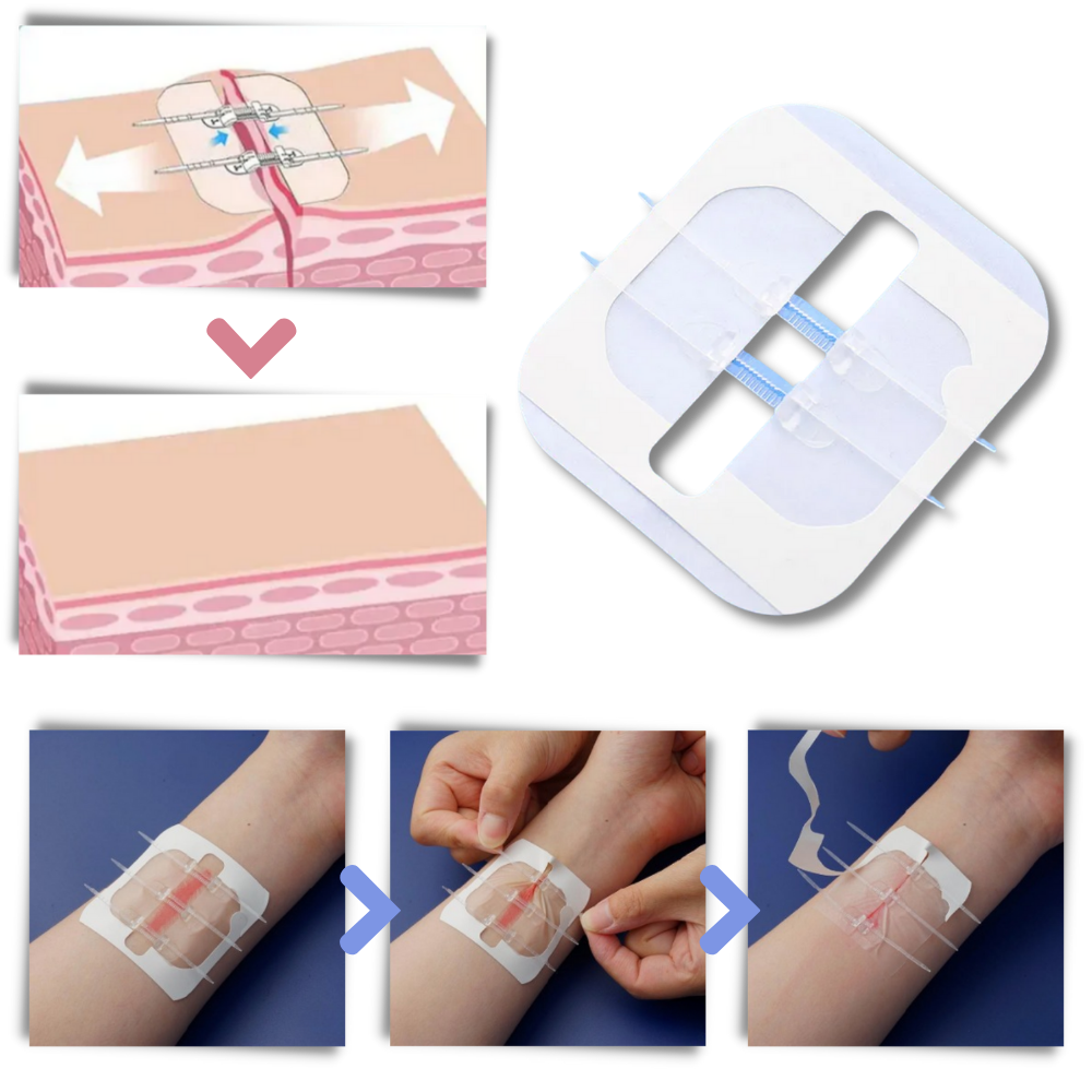 Water-proof wound adhesive - Unwavering Protection for Active Lifestyles - Ozerty
