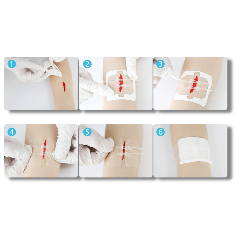 Adesivo per ferite impermeabile - Applicazione facile per una guarigione confortevole - Ozerty