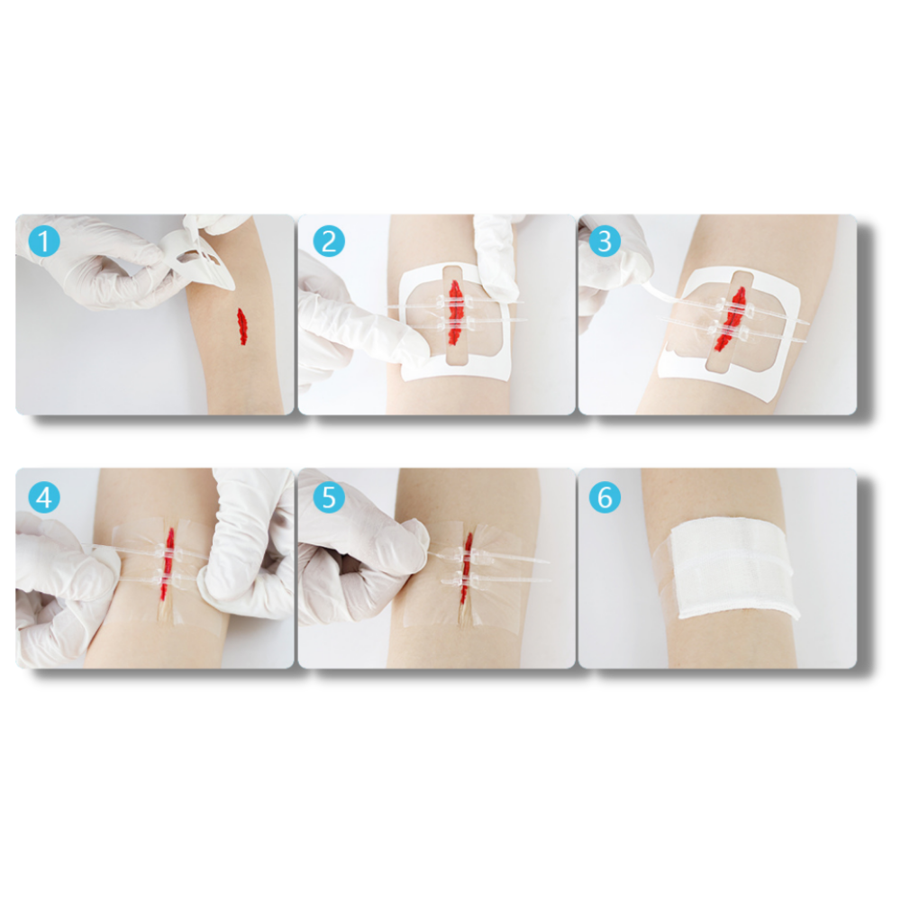 Water-proof wound adhesive - Effortless Application for Comfortable Healing - Ozerty