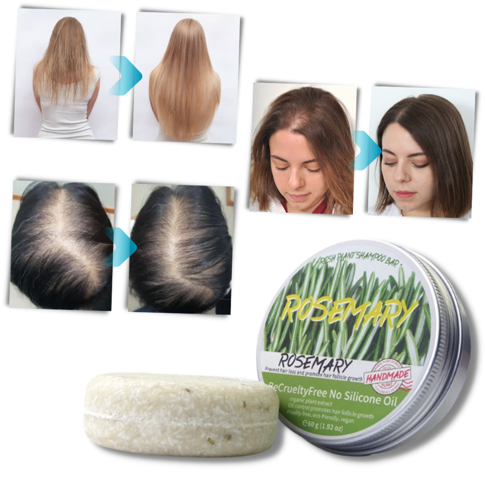 Rosemary Bar Shampoo - For Every Hair Type - Ozerty