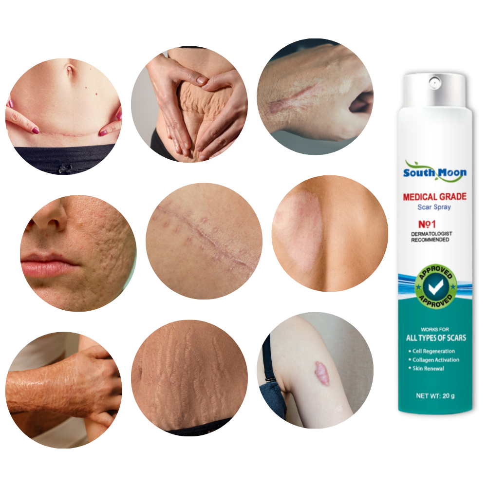 Spray thérapeutique pour l'élimination des cicatrices - Réduit de nombreux types de cicatrices - Ozerty