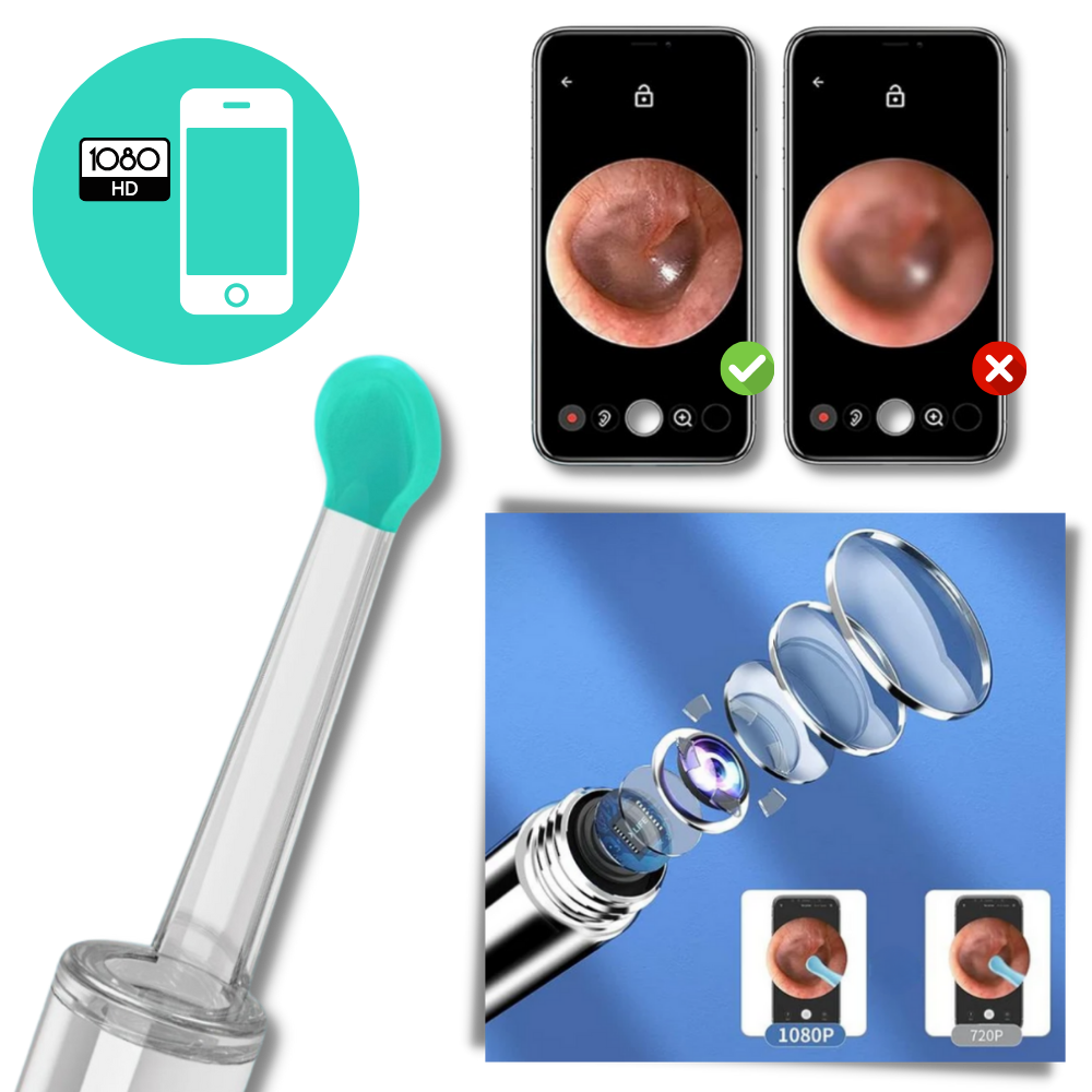 Telecamera intelligente per la rimozione del cerume dall'orecchio - Ispezione auricolare ad alta definizione - Ozerty