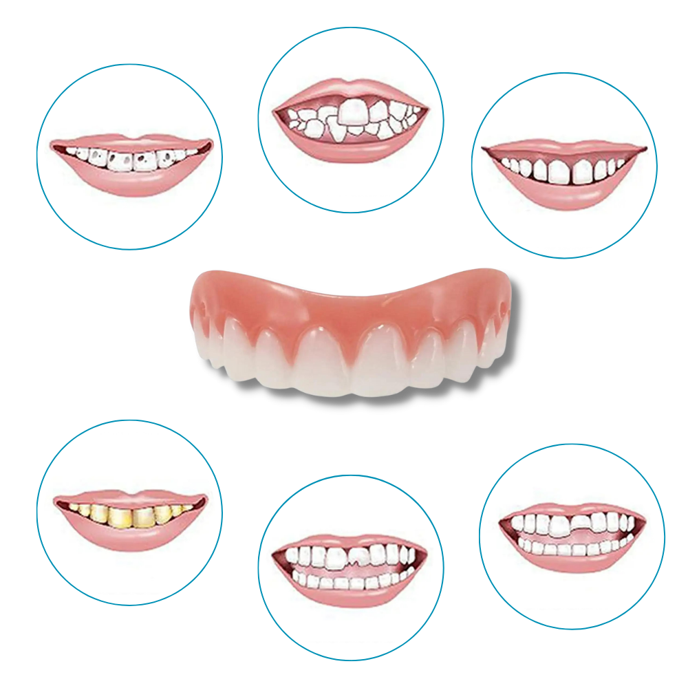 Snap-On Veneer Teeth - Technical characteristics - Ozerty