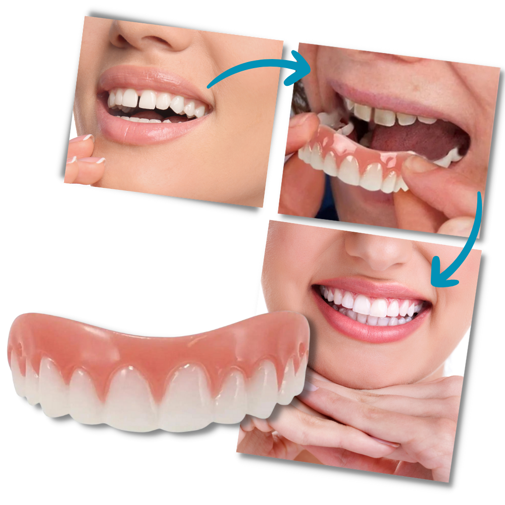 Faccette dentali a scatto - Trasformazione senza sforzo - Ozerty