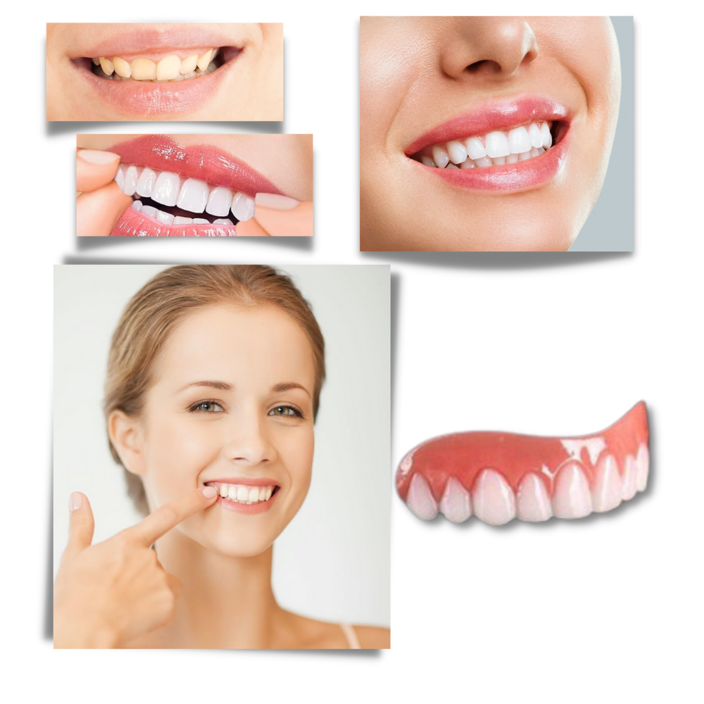 Snap-On Veneer Teeth - A Smile That Fits You Perfectly - Ozerty
