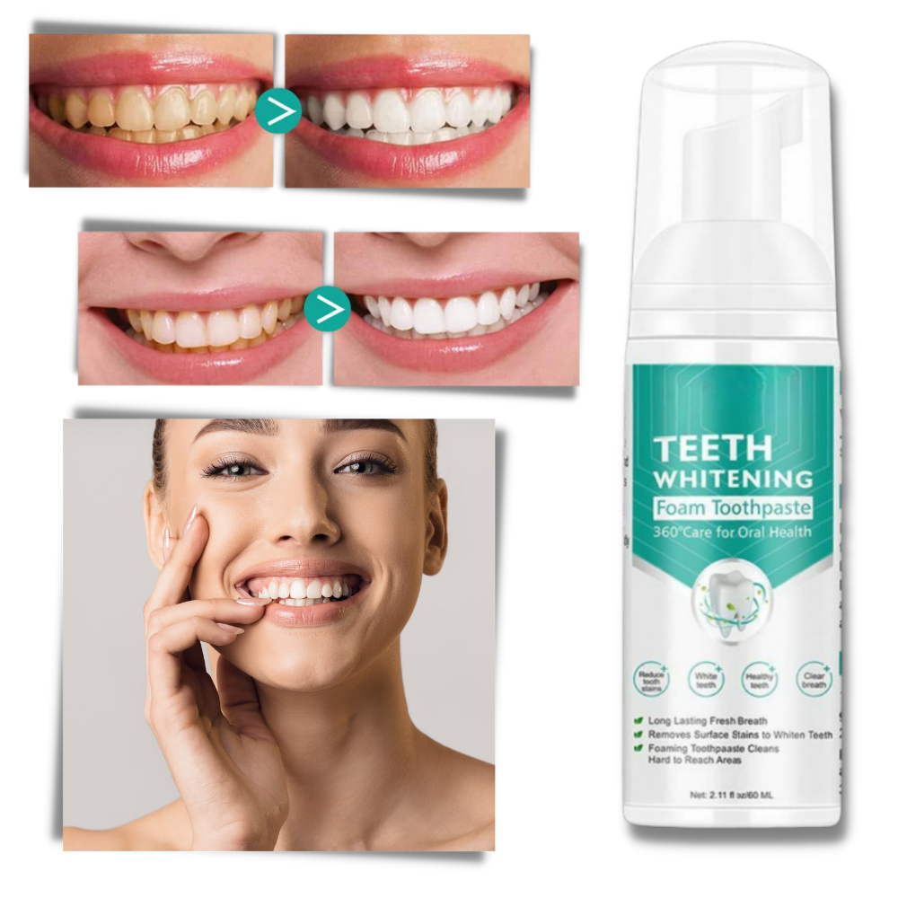 Teeth Whitening Foam - Innovative Whitening Formula - Ozerty