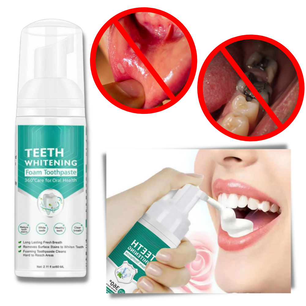 Teeth Whitening Foam - Relieves and Prevents mouth sores - Ozerty