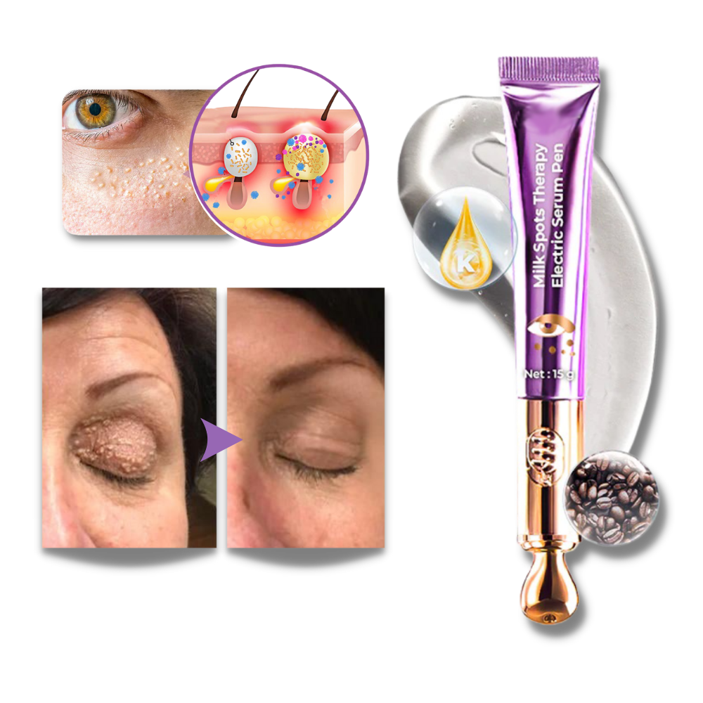 Vibrating Eye Firming Cream Device - Eliminates Milk Spots - Ozerty
