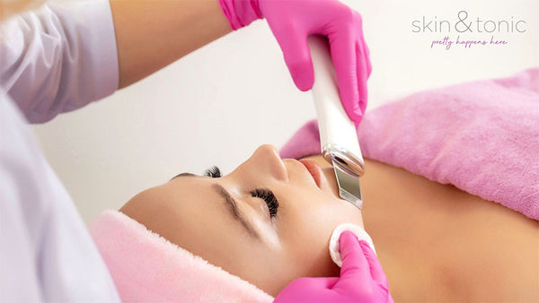 BENEFITS OF MICRODERMABRASION