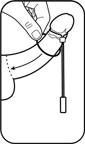 Attach Base Ring