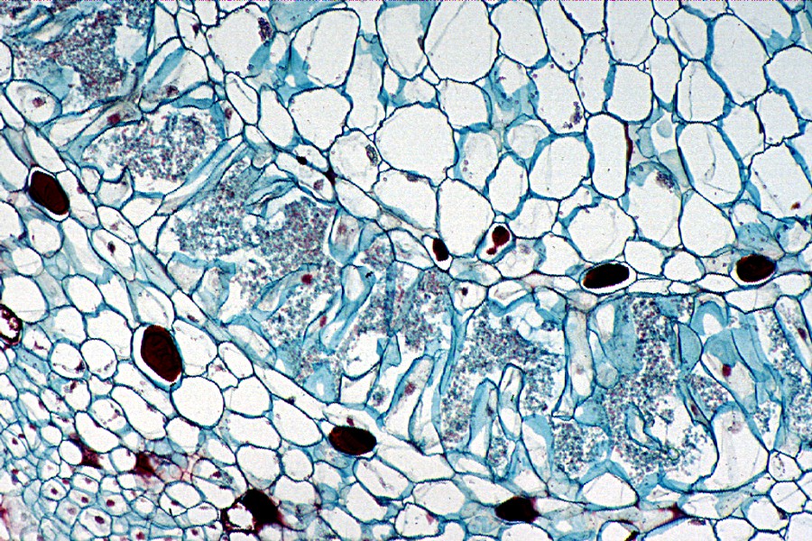 Bacteria Photo