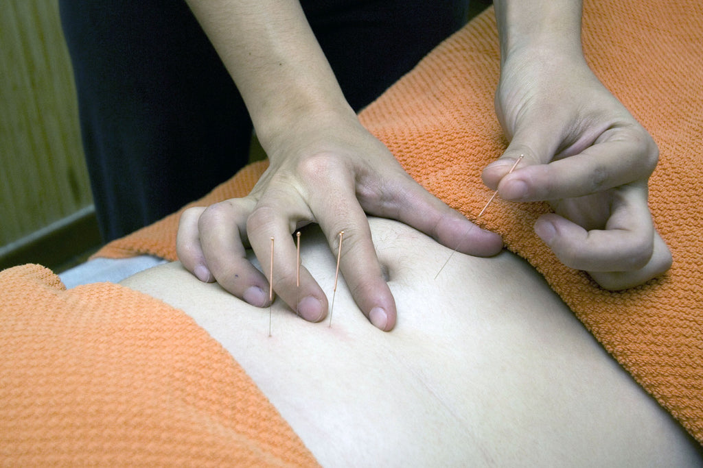 Acupuncture pain relief - Traditional Chinese Medicine