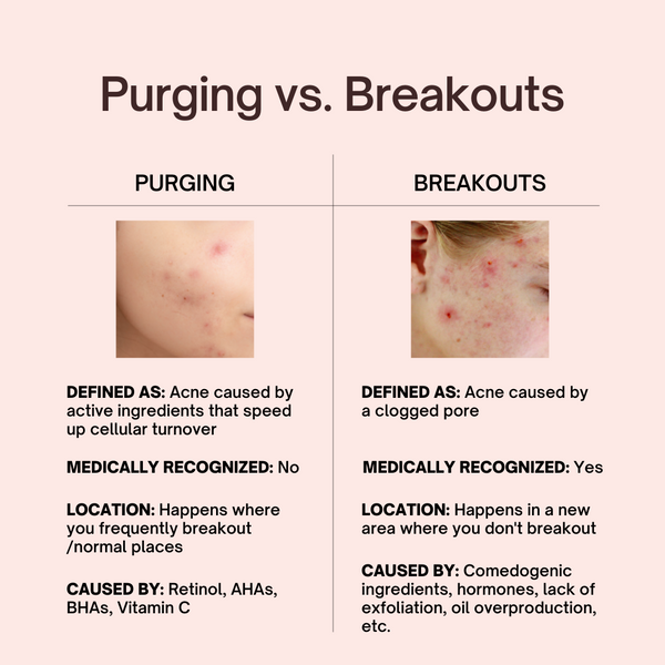 skin purging vs. breakouts