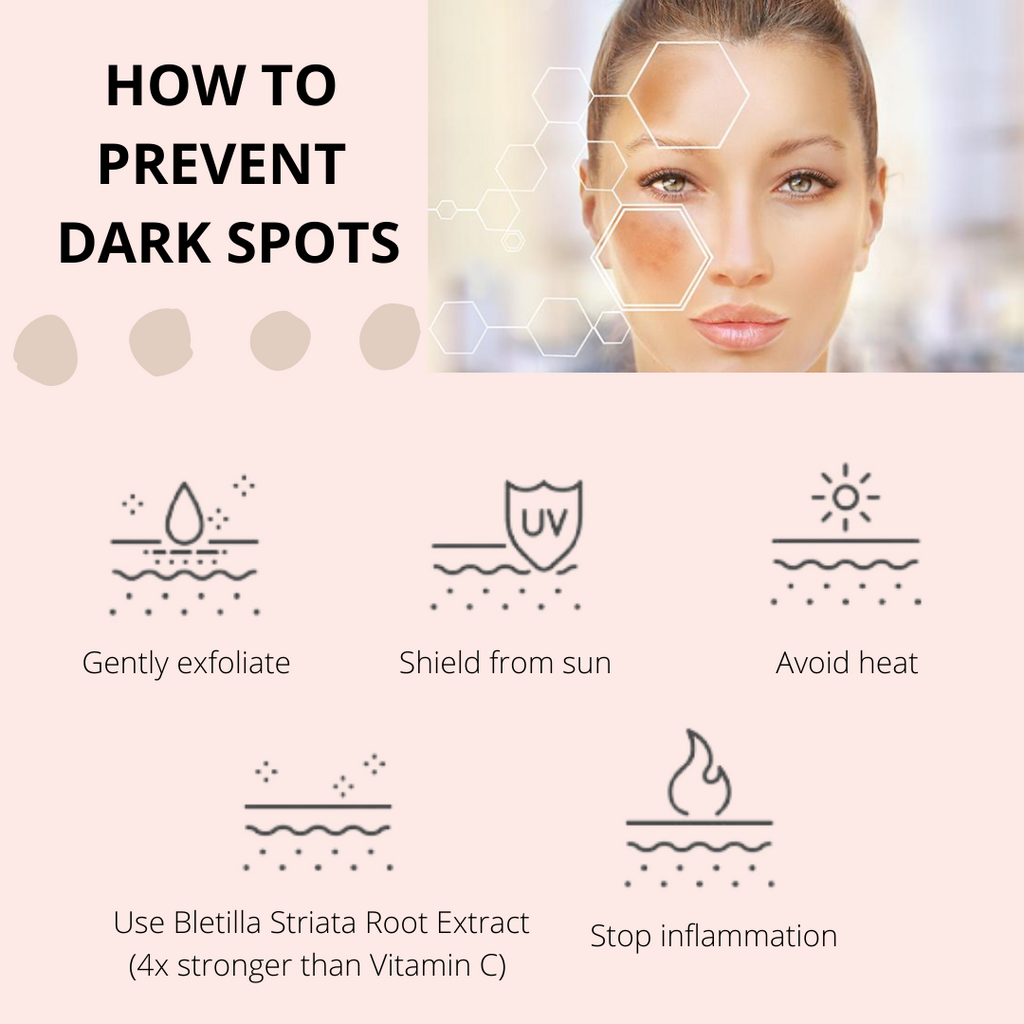 How to prevent dark spots- gently exfoliate, shield from sun, avoid heat, use Bletilla Striata root extract (4x stronger than Vitamin C), and stop inflammation