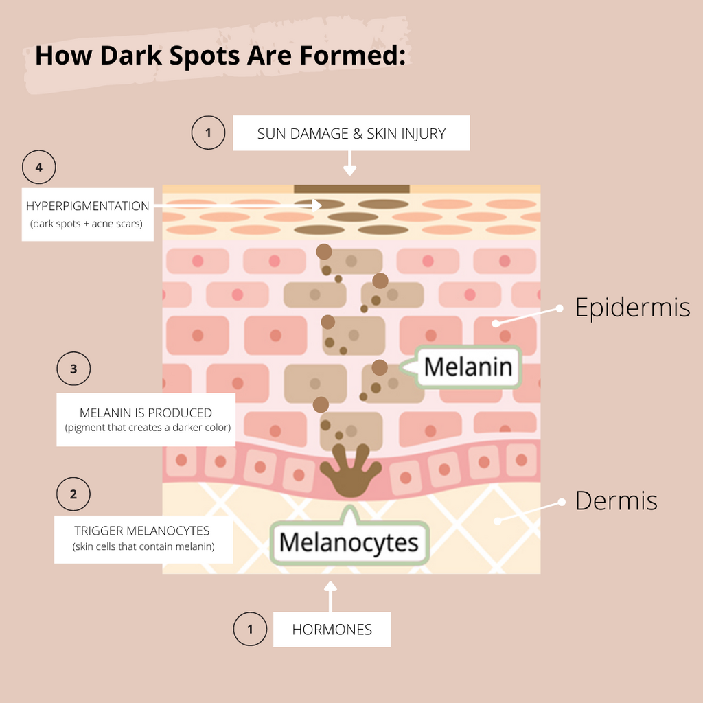 how dark spots are formed - melanin production skin image