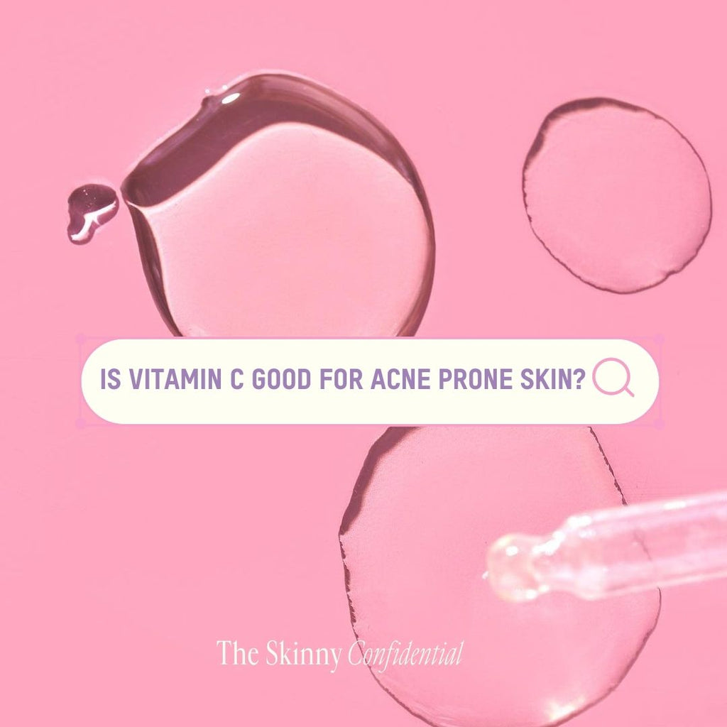 is vitamin c good for acne prone skin
